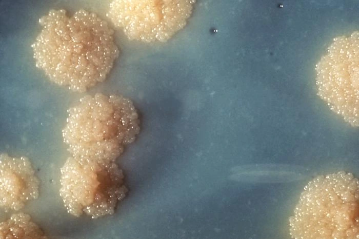 Imagen científica de archivo: cultivo de Mycobacterium tuberculosis, 1976, CDC PHIL 4428. No muestra las nuevas pruebas ni una muestra de pacientes costarricenses.