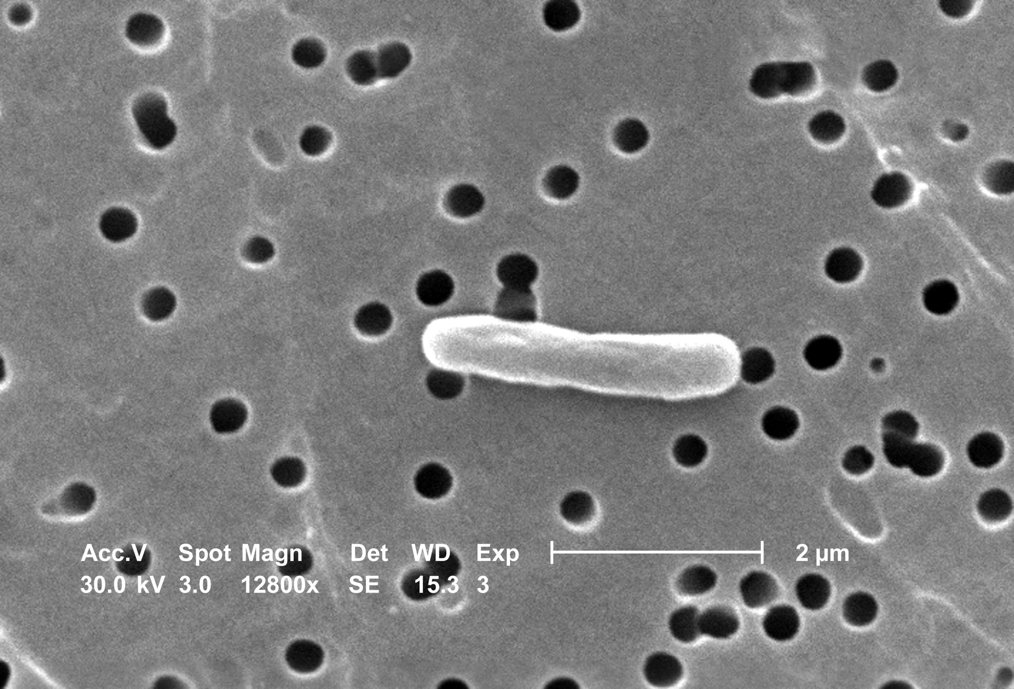 Imagen científica de contexto: micrografía electrónica de una bacteria Escherichia coli, archivo CDC PHIL 7138 de 2005. No es una muestra del brote de La Reforma ni identifica su cepa o el origen de la contaminación.
