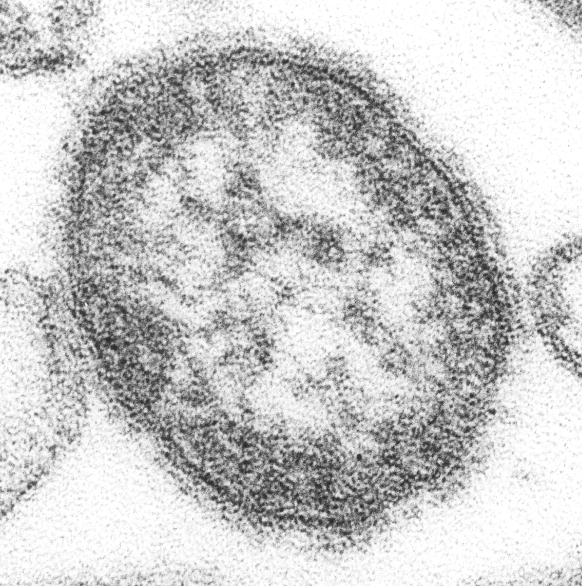 Imagen científica de contexto: micrografía electrónica de una partícula del virus del sarampión, del archivo gratuito CDC PHIL 8429. No es una muestra de la persona ni del caso investigado en Costa Rica.